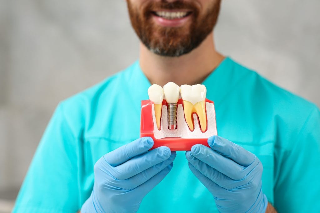 Image of a dentist holding a dental implant model