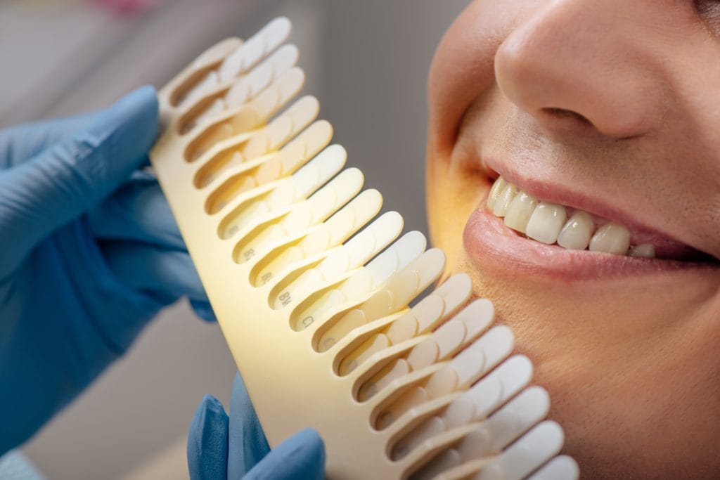 Dentist holds up a colour scale of teeth to a patients mouth for teeth whitening procedure