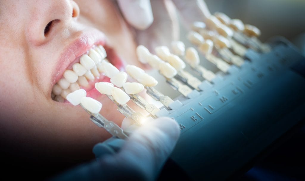 A dentist holds up some shades of white to someone's teeth in the dentist