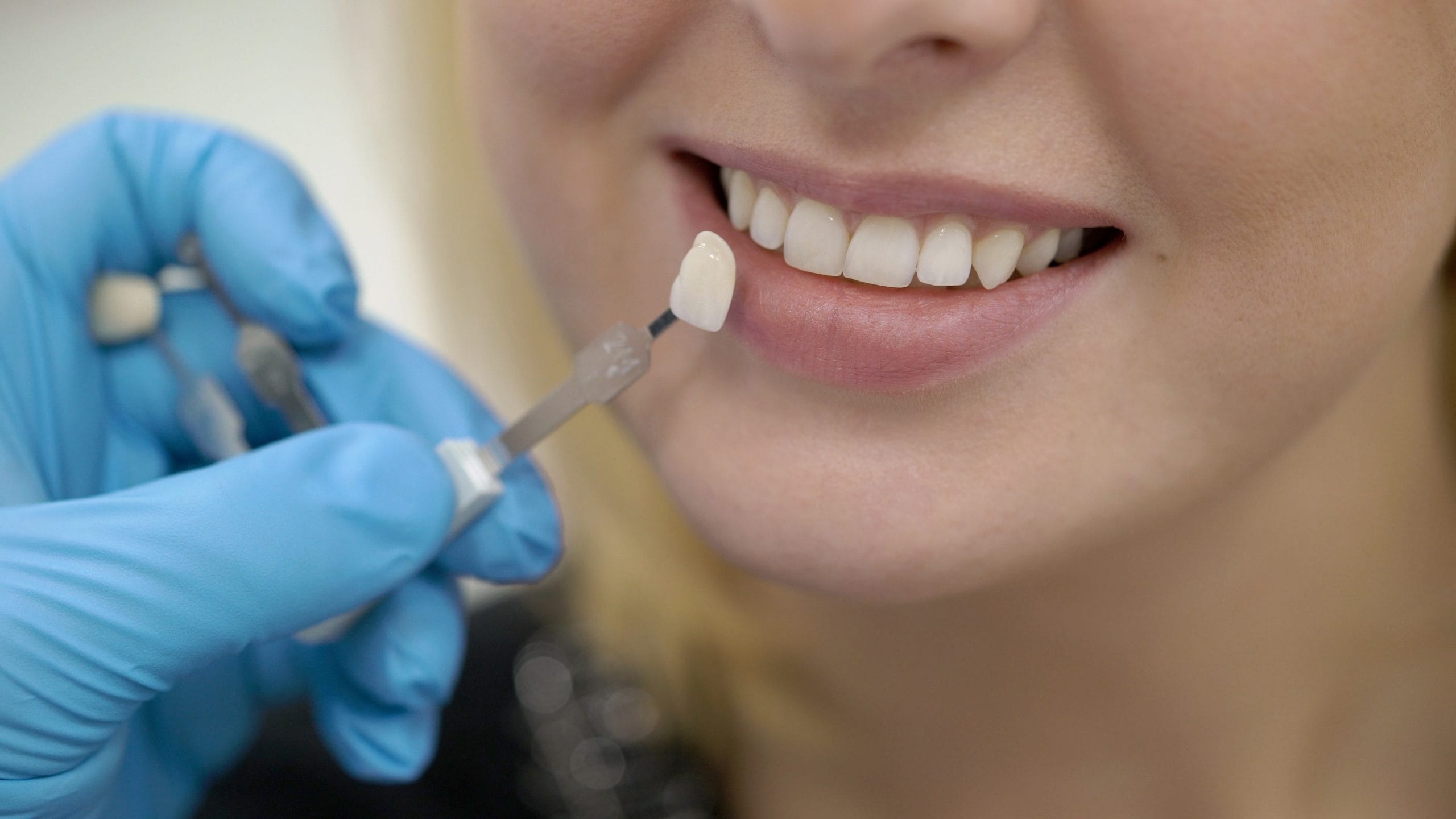 Dentist holding up a tooth to someones teeth for shade comparison
