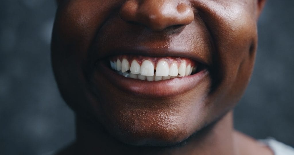 A black man smiles showing off his white teeth